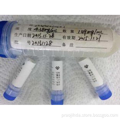 Sheep Anti - HBsAg Polyclonal Antibody Infectious Disease F
